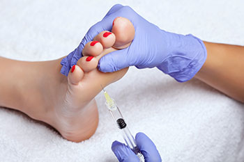 Wharton’s Jelly in Regenerative Medicine for Podiatry
