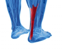 Where Is the Achilles Tendon Located?