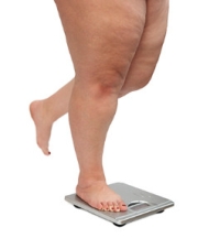 Can Plantar Fasciitis be Linked to Obesity?