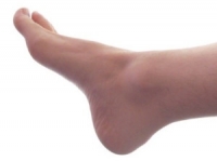 What is Tarsal Tunnel Syndrome Caused By?