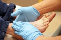 How to Take Proper Care of a Diabetic Person's Feet